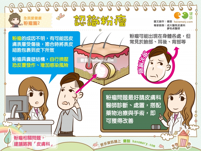 粉瘤,表皮囊腫,表皮樣囊腫,健康圖文,健康漫畫,漫漫健康,Epidermal cyst, Epidermoid Cyst, 健談,健談網,havemary