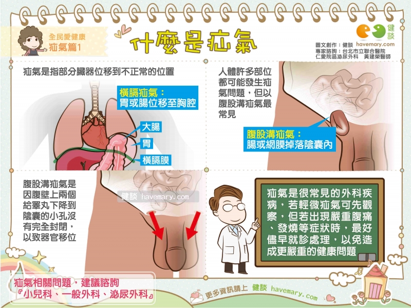 疝氣,腹股溝疝氣,小兒疝氣,健康圖文,健康漫畫,漫漫健康,Hernia, inguinal hernia, infantile hernia,健談,健談網,havemary