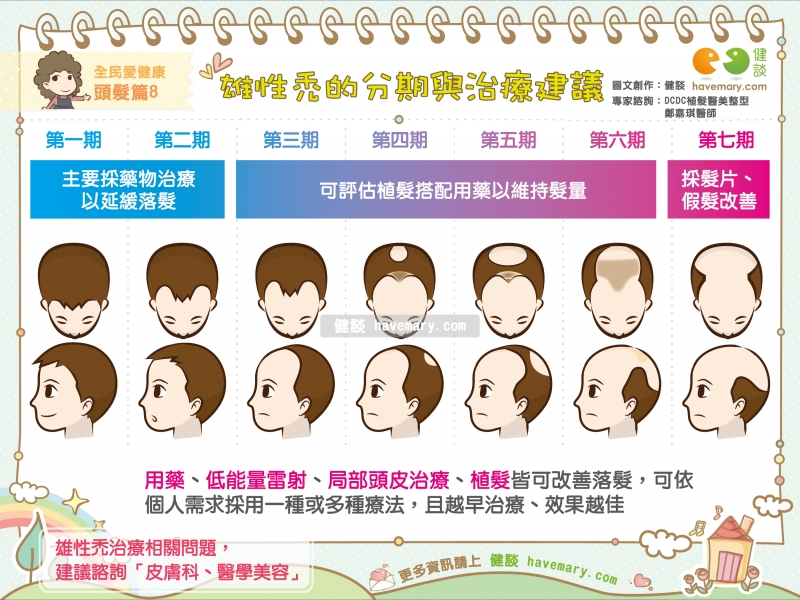 雄性禿,禿頭,中年禿,落髮,大量落髮,掉頭髮,健康圖文,健康漫畫,漫漫健康,Male baldness,Bald,健談,健談網,havemary