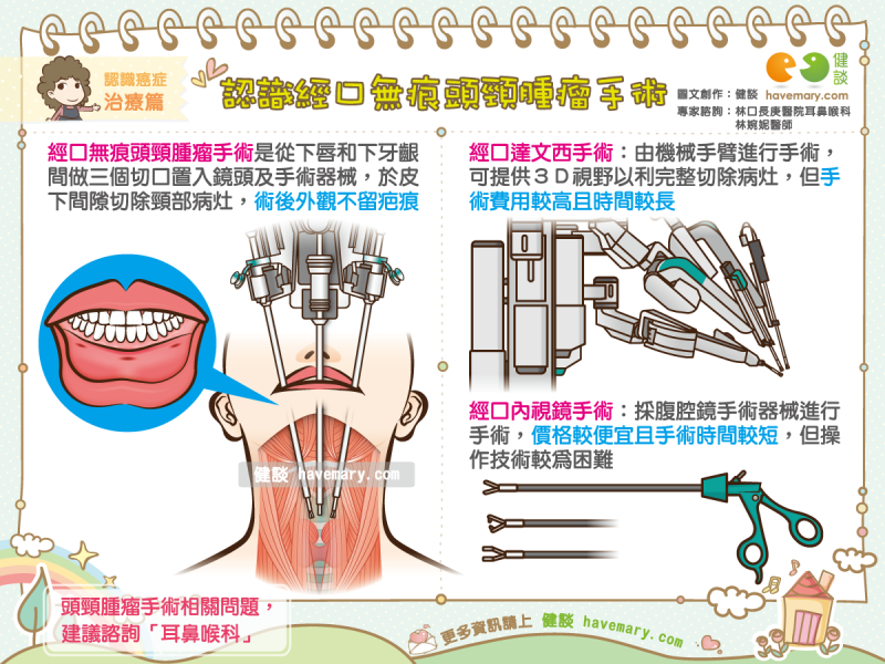 頭頸腫瘤,頭頸腫瘤手術,內視鏡手術,達文西手術,林婉妮,林婉妮醫師,健康圖文,健康漫畫,漫漫健康,圖解健康,Head and neck tumors, head and neck tumor surgery, endoscopic surgery, Da Vinci surgery,健談,健談網,havemary