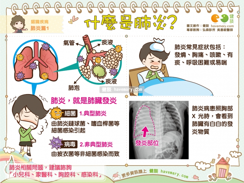 「非典型肺炎」的圖片搜尋結果