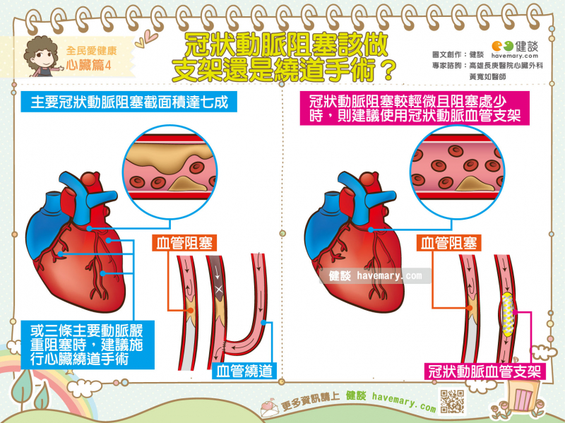 心肌梗塞,心血管阻塞,冠狀動脈堵塞,心臟繞道手術,血管繞道手術,心臟支架,高血脂,血管阻塞